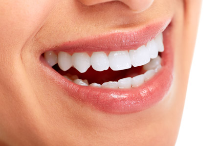 Instant Smile Teeth Top Veneer Replacement Kit Porcelain White